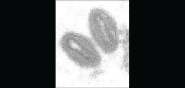 Monkeypox: what is it and should we be concerned?