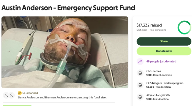 Fundraiser created for swimmer injured during a boating collision on Skeleton Lake